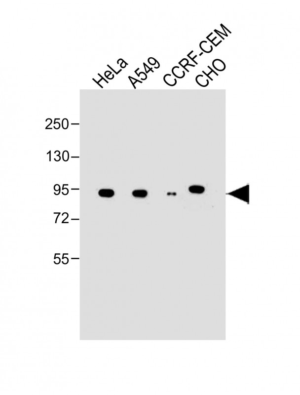 WB - NR3C1 [Knockout Validated] AM8721b